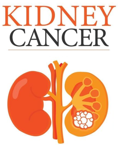 kidney cancer