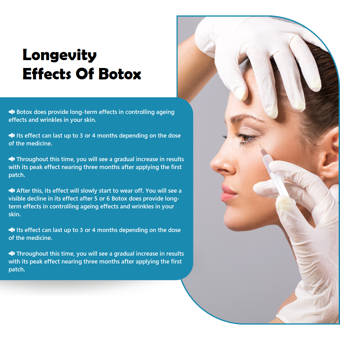 Longevity Of Effects With Botox 
