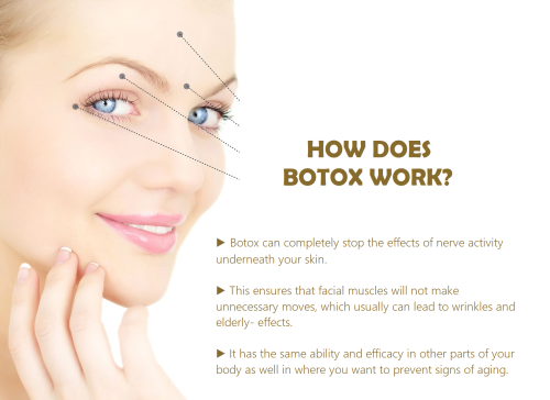 How Does Botox Work?