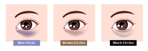 Dark Circles