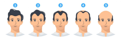 Helps In Reducing Baldness (1)
