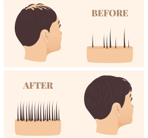 Prevents Premature Hairfall