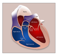 Cardiac Death 