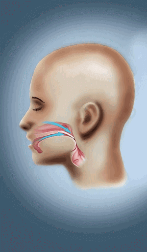 Sleep Apnea