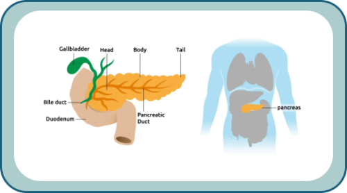 Pancreatic Cancer