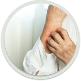 Fungal Infections