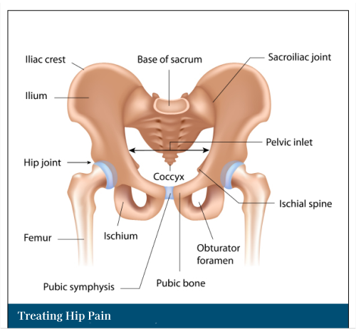 Treating Hip Pain