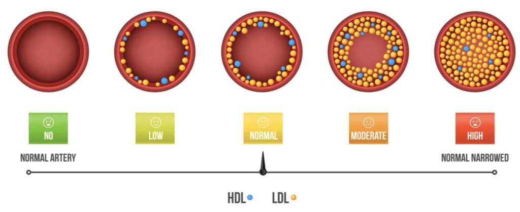 What Is Atorvastatin? The Benefits, Uses, Dosage, And Side Effects 4 What Is Atorvastatin